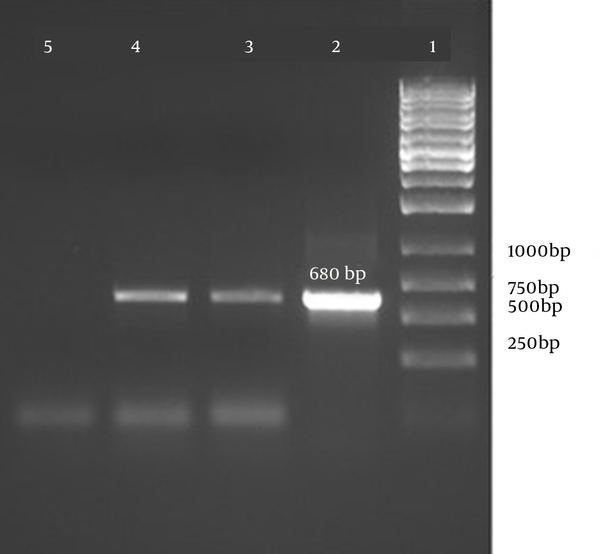 Lane 1, molecular size marker; Lane 2, Positive control; Lane 3 and 4, DNA extracted from S. aureus samples; Lane 5, Negative Control.
