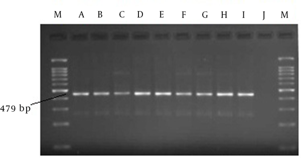 M, marker 100 bp; A, positive control; B-I, replicated regions in serum samples; J, negative control.