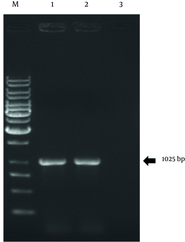 1, The native LIP2 gene of Y. lipolytica DSM 3286 native strain; 2, The mutant LIP2 gene of Y. lipolytica U6 mutant strain; 3, The negative control; M, Marker, Gene Ruler TM 1 kbp DNA ladder.