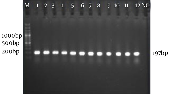 M: 100 bp marker plus DNA ladder (Fermentas Inc.). SP: lanes 1 to 3; SG: lanes 4 to 12, NC: negative control (S. enteritidis).