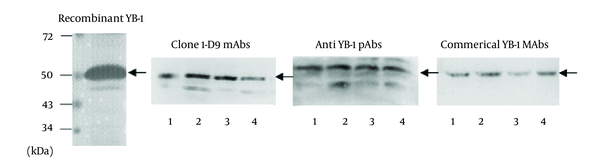 Recombinant YB-1 protein and lysates from tumor cells were immunostained with anti-YB-1 PAbs, mAbs 1-D9 and commercial YB-1 mAbs against YB-1. lane 1, recombinant YB-1; lane 2, breast cancer cell MDA-MB-231 lysates; lane 3, hepatic carcinoma cell HepG2 lysates; lane 4, non-small-cell lung cancer cell A549 lysates. Arrows indicated 50kDa YB-1.