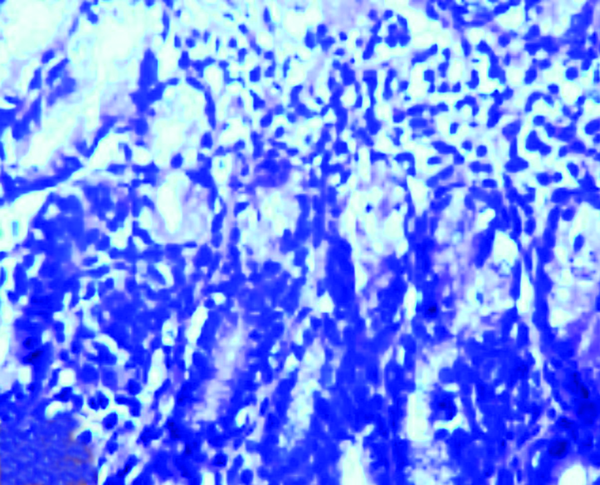Lymphocytic Plasmacytic Gastritis in the Gastric Mucosa of a Cat with Naturally Acquired Helicobacter Species Infection Together with Chronic Follicular Gastritis (H&E Stain)