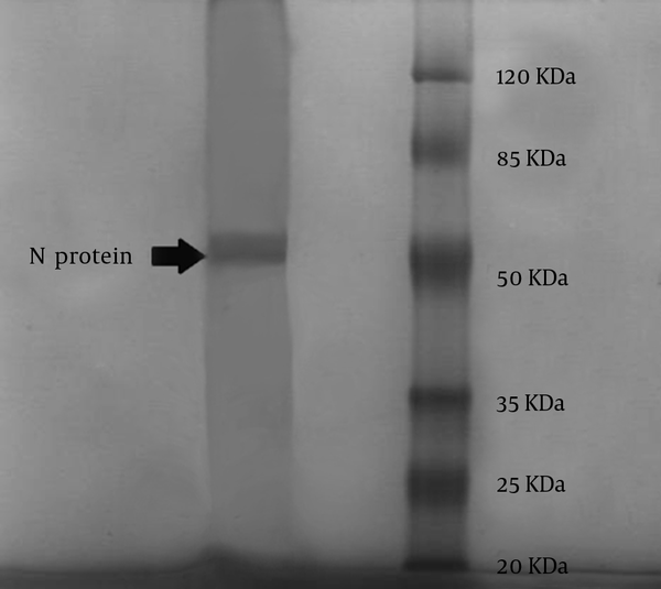 SDS-PAGE, Nucleoprotein After Purification on Cesium Chloride (CsCl0 With Protein Ladder (Fermentas, UE).