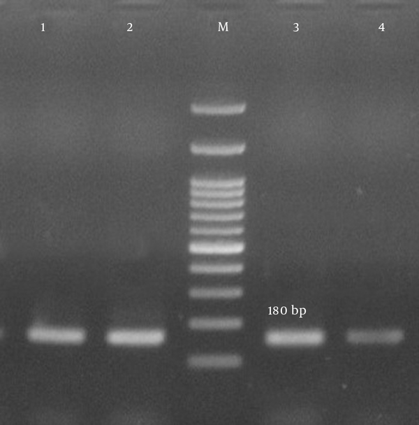 Lane M, 100-bp DNA ladder (Fermentas, UK); lanes 2 - 4, the 180-bp PCR product of luk-PV; lane 1, the positive control.