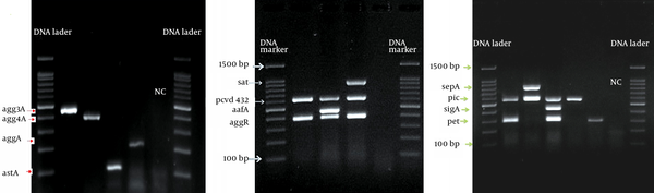 A, The M-PCR for agg3A, agg4A, aggA and astA; B, M-PCR for satA, aafA, cdv432 and aggR genes; C, sepA, pic, sigA and pet genes; NC = negative control. The electrophoresis was carried out for 1 hour at 100 V and the gels were stained with UV illuminating dye (SYBR green).