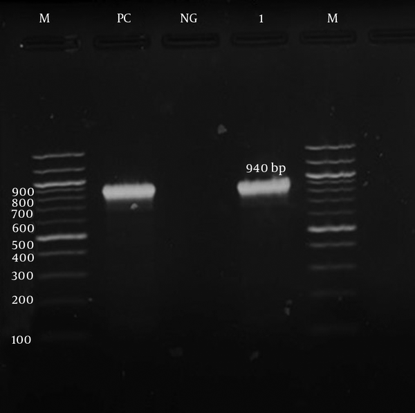 M, marker; PC, positive control; NG, negative control; Lane 1 is a sample with the MS phenotype.