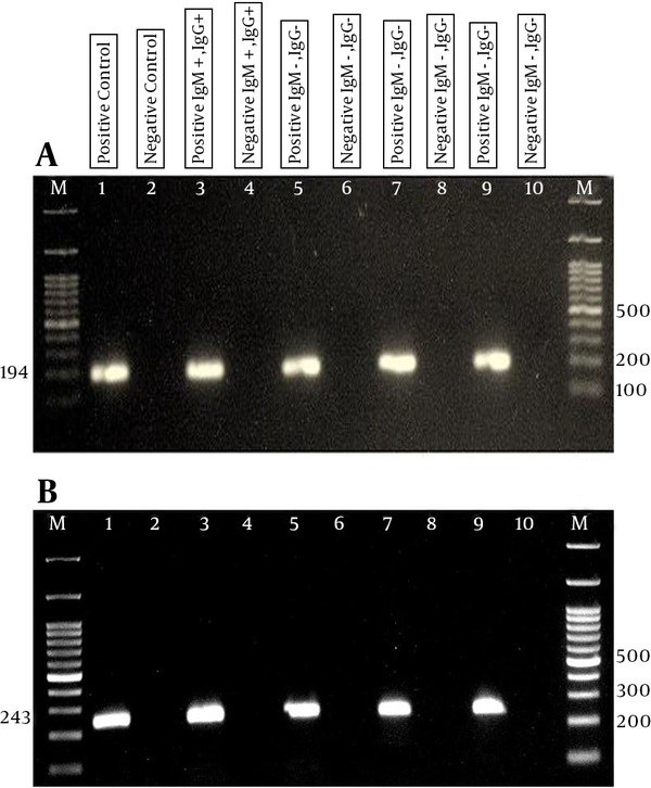 A, B1-nested PCR analysis of T.gondii DNA; B) RE-nested PCR analysis of T.gondii DNA. Line M, ladder; line 1, positive control; line 2 negative control; lines 3 and 4 positive and negative for IgM+ and IgG+; lines 5 and 6 positive and negative for IgM- and IgG-; lines 7 and 8 positive and negative for IgM- and IgG+; lines 9 and 10 positive and negative for IgM+ and IgG-.