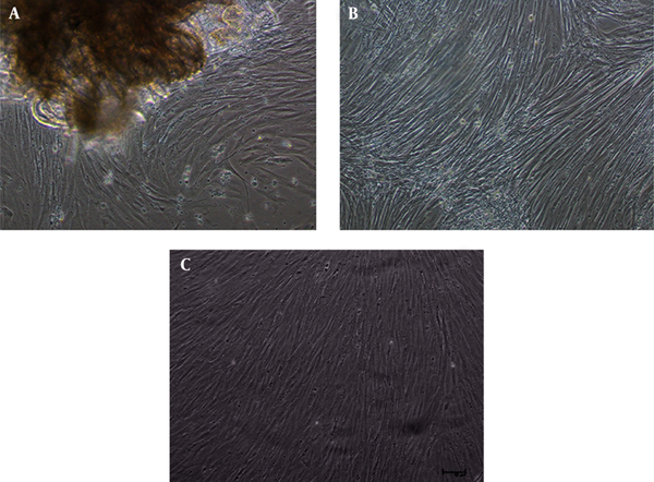 A, Confluent monolayer around the explants within 18-22 days (100X); B, Subcultured cells at passage 10 (100X) and C, Homogenous fibroblast like cells observed at passage 50 (100X).