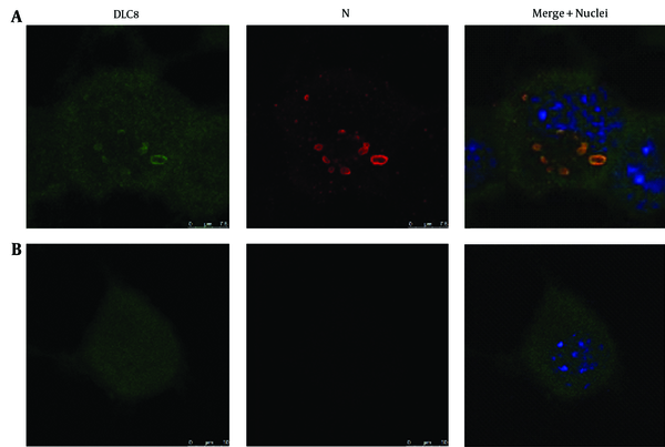 Blue, green, and red fluorescence reflects viable nuclei, host protein DLC8, and N protein of RABV, respectively. A, RABV-infected cells; B, Mock-infected cells. Scale bars = 7.5 μm or 10 μm.