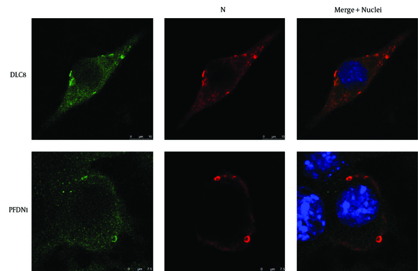 Nuclei (blue) were stained with 4', 6-diamidino-2-phenylindole (DAPI). PFDN1 and DLC8 are in green and the N protein of RABV in red. Scale bars = 7.5 μm or 10 μm.