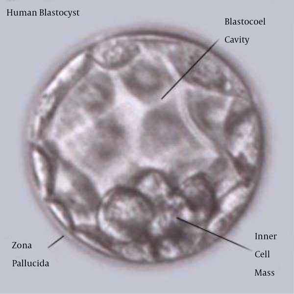 Human Blastocyst