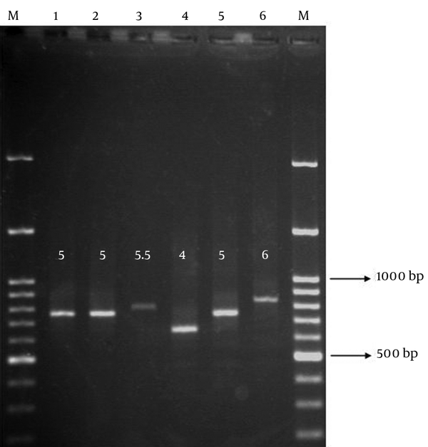 The PCR products of different isolates using "ms11" primers have been loaded on the agarose gel.