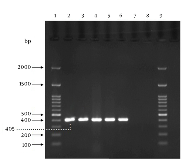 Lanes 1 and 9,100 bp DNA ladder; lane 2, GBS ATCC 12386 (positive control); lanes 3, 4 and 5, positive specimens in both PCR and culture method; Lane 6, the specimen that was negative in culture method but positive by PCR; lane 7, the specimen that was positive using culture method but negative by PCR; lane 8, negative control (sample without template).