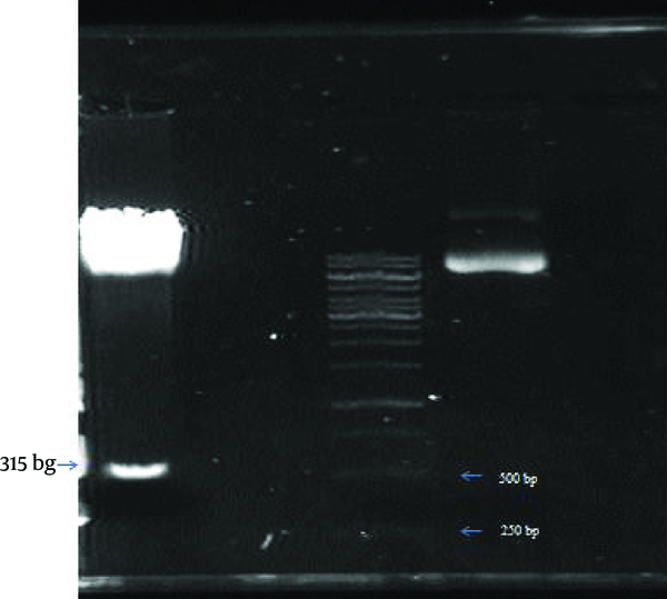 On the left, LTR fragment that was digested from pUCLTR-LacZ vector by HindIII enzyme, slighly above 500bp band of 1 kb lambda marker bands (second band from the bottom) can be seen. Undigested vector can be seen on the right.