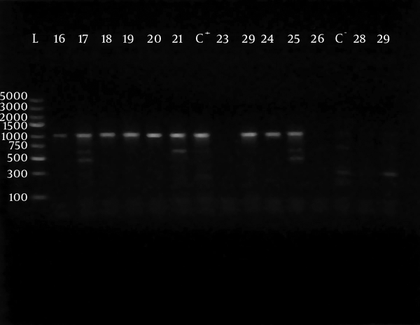 L lane, molecular weight marker; Gene Ruler 100 - 5000 bp DNA ladder, lanes numbered 21, 22, 23, 26, 27, 30, 31, 32, 33, 34 and 35 show (971 bp) bands of PCR products, lanes numbered 24, 25 and 29 show negative results, while lane C- shows negative control.