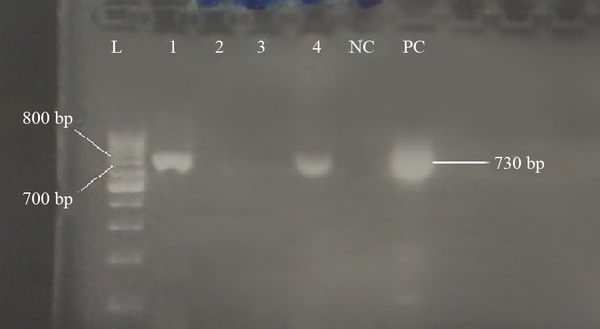 L: 100 bp DNA ladder, NC: negative control, PC: positive control, 1 to 4: patient’s sera.