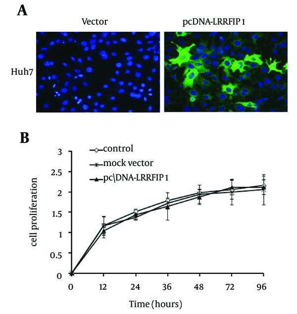 A, Overexpression of LRRFIP1 in Huh7 cells was detected by immunofluorescence assay. B, LRRFIP1 overexpression had no impact on Huh7 cell proliferation.