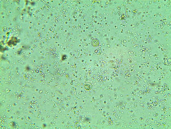 Cyclospora Oocysts Saline Preparation (400 x)