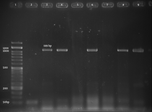 Lane 1, 50 bp DNA marker; lane 2, negative control; lane 3, positive control; lane 4, 6, 8, and 9, positive samples; lane 5 and 7, negative samples.