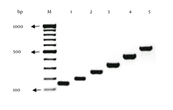 Ambler; blaKPC, blaGES, blaIMP-1, blaVIM-2, blaNDM-1, and blaSPM-1 by multiplex PCR. Clinical isolates harboring blaIMP-1 (Pseudomonas aeruginosa; lane 2), blaVIM-2 (Pseudomonas aeruginosa; lane 3), NDM-1 (Klebsiella pneumonia; lane 4), KPC (Klebsiella pneumonia; lane 5), blaGES (Pseudomonas aeruginosa; lane 6) and blaSPM-1 (Pseudomonas aeruginosa; lane 7) were used as PCR controls. The molecular size marker (lane 1) was a 100 bp ladder.