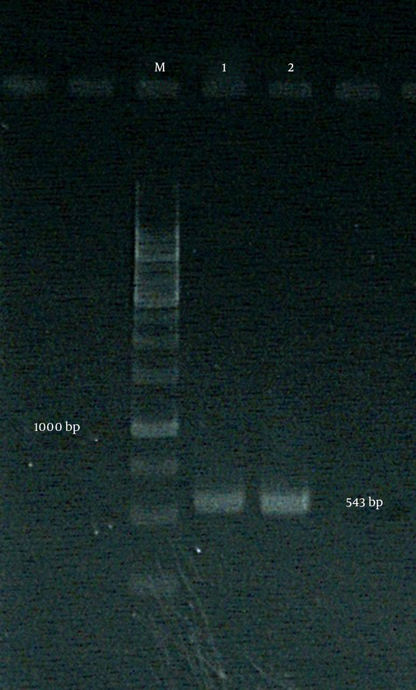 Lane M: GeneRuler™ 1 kb DNA ladder (fermentas); lane 1: cpcB PCR product.