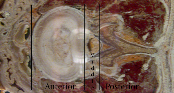 A Cross Section of the Lumbar Vertebral Level Showing the Different Sections of the Spine