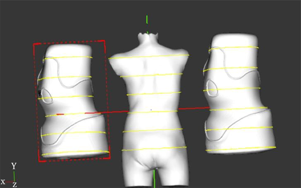 Right, basic brace model for this pattern of curvature; left, final model as individualized (see also https://bestpracticebracing.wordpress.com/bracing-scoliosis/).