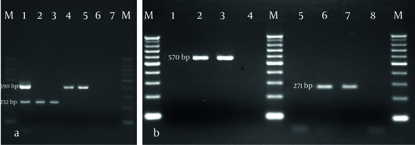 Part a: Multiplex PCR detection of blaIMP1 (232bp) and blaVIM2 (390bp),(lanes: M:100bp marker, 1: positive control, 2 and 3: PCR product of blaIMP1 gene, 4 and 5: PCR product of blaVIM2 gene, 6 and 7: negative controls) Part b: PCR detection of blaSIM1 (570 bp) and blaSPM1 (271 bp), (lanes: M: 100 bp marker, 1, 4, 5, and 8: negative controls, 2 and 3: positive control of blaSIM1 gene, 6 and 7: positive control of blaSPM1 gene)