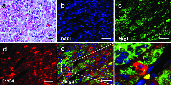 (a) Haematoxylin-eosin (H &amp; E) staining. (b-e) Double Immunofluorescence Staining for Nrg1 and ErbB-4 were revealed in the pituitary of the rhesus monkey. Blue, DAPI stained nuclei. Adjacent staining of Nrg1 and ErbB4 were revealed in the pituitary (inset). Scale bars = 50μm.