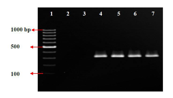 Column 1, 1000 bp DNA ladder (Fermentas, Latvia). Columns 2-7, PCR reaction: 2= none template control, 3= S. aureus ATCC 25923 (negative control), 4= S. aureus ATCC 29213 (positive control), 5-7=MRSA strains.