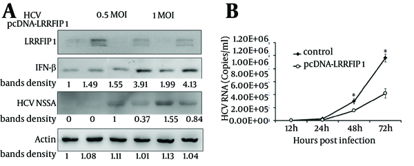 A, Huh7 cells were transfected with LRRFIP1-pcDNA or mock vector. Twenty-four hours after transfection, cells were infected with HCVcc. Protein levels of LRRFIP1, IFN-β and HCV NS5A were determined by western blotting. B, HCV RNA levels were determined by real-time PCR in Huh7 cells transfected with pcDNA-LRRFIP1 or vector control. Data were represented as Means ± SD, n = 3. (* P &lt; 0.05, compared with control).