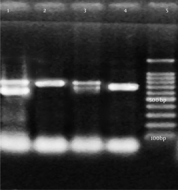 Lane 5, 100 bp DNA ladder; lane 4, sample 1; lane 3, sample 2; lane 2, sample 3; lane 1, sample 4 (TEM: 800 bp, SHV: 713 bp).