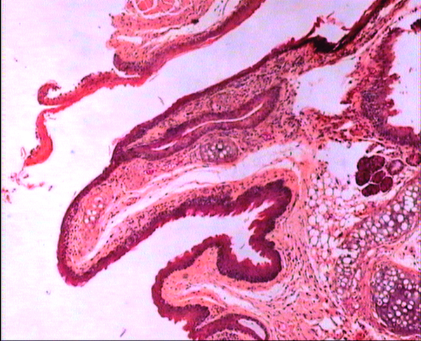 The stratified squamous epithelium of trachea and esophagus in BALB/c mice treated with 7.5 mg/kg/day b/w dose. H&E ×80.