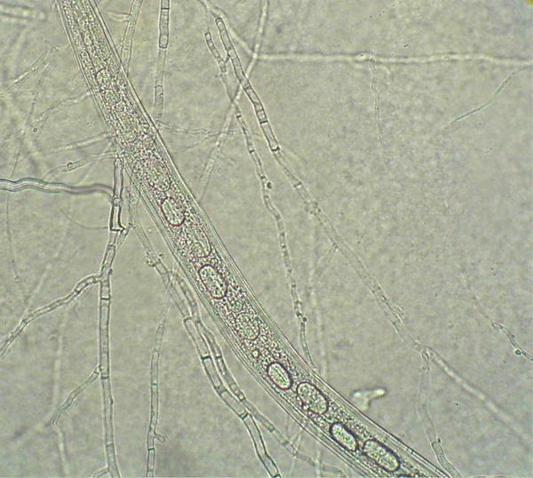 The Trapped Nematode Larvae by Mycelium of Fungus
