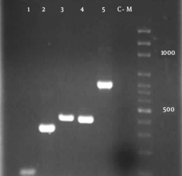 Lane M: Molecular weight marker 100 bp DNA ladder; Lane 1: amplified sfa 100 bp; Lane 2: amplified pap gene 328 bp; Lane 3: amplified fim gene 400 bp; Lane 4: amplified foc gene 388 bp and Lane 5: amplified afa gene 750 bp.