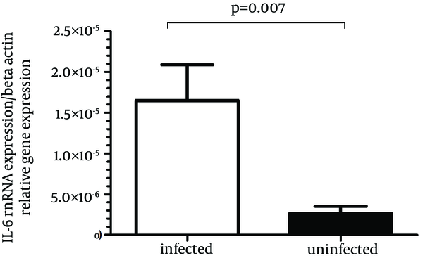 Relative Expression Level of IL-6 mRNA in H. pylori-Infected Patients is Shown by the Grade of Chronic Gastritis