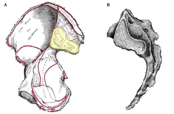 The SI joint articular surface is highlighted in the left image.