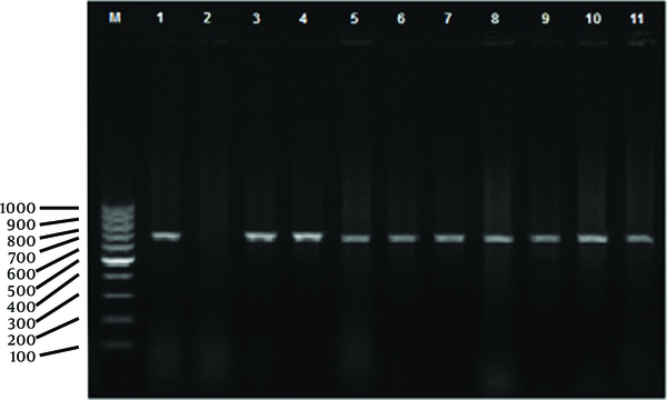 Lane M, Marker 100 bp (base pair) DNA Ladder (Fermentas, Slovenia), lane 1, Positive Control (B. melitensis, Rev 1 strain, Razi, Iran), lane 2, Negative Control (Water), lanes 3-11 Samples