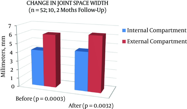 Change in the joint Space Width of Internal and External Tibiofemoral Compartments (in mm), Before and After Ozone Therapy