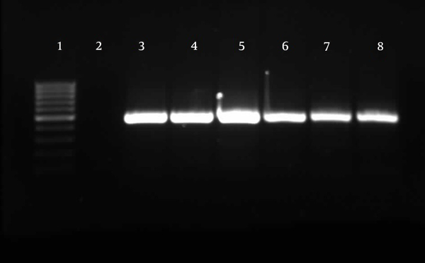 The expected size was 469 bp. All isolates were positive for these loci. Line 1, 100 bp DNA ladder (Fermentas, Latvia); line 2, negative control; lines 3 -8, positive loci.