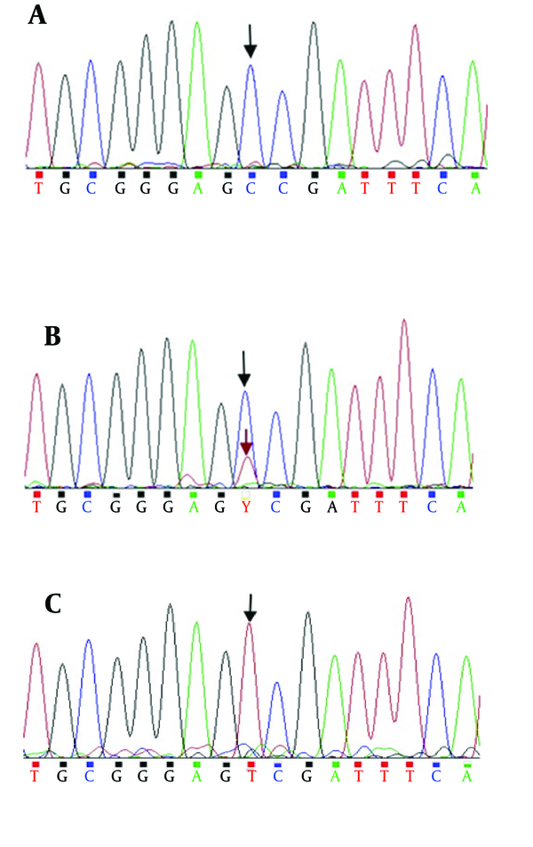 M: DNA molecular weight marker (50 bp); lane 1: heterozygous polymorphic (CT); lanes 2, 3, 5: homozygous wild type (CC); and lane 4: homozygous polymorphic (TT).