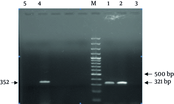 M-DNA size ladder 100 bp (Fermentas), number 1: reference strain for orf-10 (K2); number 2: clinical isolate for K2 positive; number 3: negative control for orf-10 (K2 serotype); number 4: reference strain for wzc (K1); number 5: negative control for wzc (K1)