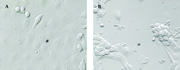 A: confluent monolayer noninfected MA104 cells; B: infected MA104 cells and CPE.