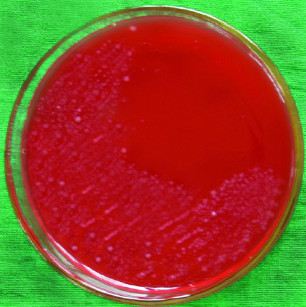 The colonies of H. pylori on Columbia Blood Agar Medium