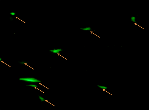 Expression of Green Fluorescent Protein in transfected Wallago attu Muscle Cells (100X)