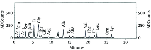 Chromatography of Patient’s Blood Amino Acids, Before Treatment