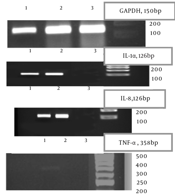 RNA quality was assessed by PCR using primers for GAPDH. The induction of IL-1α, IL-8 and TNF-α were examined.1, HeLa cell treatment with native shiga toxin; 2, HeLa cell treatment with recombinant toxin, ; 3,control HeLa cell RT-PCR by GAPDH, IL-1α, IL-8, TNF-α.