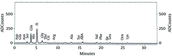 Chromatography of the Patient’s Cerebrospinal Fluid Amino Acids, Before Treatment