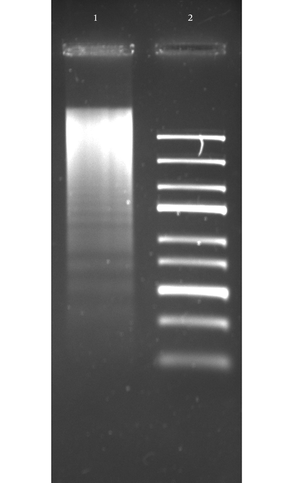 HeLa cells were subjected to 150 µg/mL of CDT preparation for 24 hours, after DNA was obtained and visualized by electrophoresis, in 1.2% agarose gel stained with ethidium bromide. Lane 1, DNA obtained from HeLa cells with CDT treatment; Lane 2, Gene Ruler Express DNA Ladder (Fermentas, USA).
