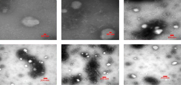 Spatial Characterization of Extracted Membrane Vesicles in Negative Staining Captured by a Zeiss EM10C Transmission Electron Microscope